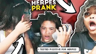 I GAVE YOU HERPES PRANK ON OBEYTONI 😱🤮 CRAZY REACTION MUST WATCH [upl. by Coy]