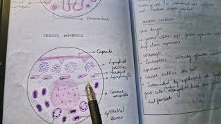 TB lymph node histopathology [upl. by Silvan]