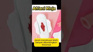 GEJALA KISTA endometriosis rahim [upl. by Atrim]