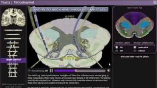 Axiom Neuro 3D Neuroanatomy  Tracts and Pathways Module [upl. by Norvall]