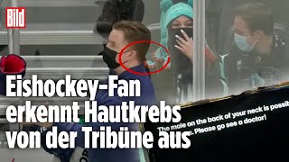 Hautkrebs Medizinstudentin rettet NHLBetreuer per HandyNachricht das Leben [upl. by Pogue]