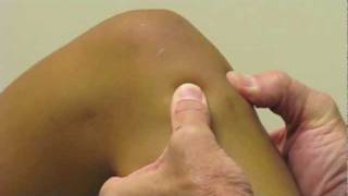 ACL Exam Lachmans Test Pivot Shift Drawer Test performed by Dr Eric Janssen [upl. by Ijan]