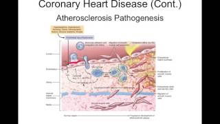 Chapter 18 Alterations in Cardiac Function BIOL300 [upl. by Siraval]