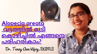 Genetic Hair Loss Treatment  Dr Satyajeet Kangle [upl. by Urbana]