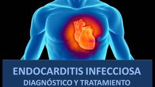 Endocarditis infecciosa  Diagnóstico y tratamiento [upl. by Henryk]