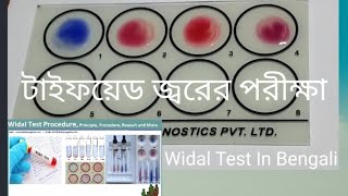 Widal Test Typhoid Paratyphoid Test Widal Test In Bengali Widal Test In BanglaLab Technician Rajib [upl. by Adrahc]