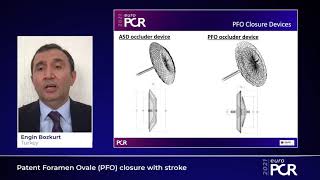 Patent Foramen Ovale PFO closure with stroke  EuroPCR 2021 [upl. by Roland948]