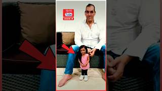 সবচেয়ে বেঁটে মহিলা বয়স ৩০ বছর 😱  🤯 Shortest Woman Living  Jyoti Amge shorts facts [upl. by Nytram134]