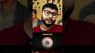 Human Eye disease [upl. by Jb]