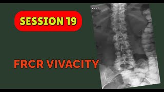 FRCR VIVACITY SESSION 19 [upl. by Yaj]