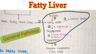 Fatty Liver  Steatosis of Liver  Fatty Change in Liver  General Pathology [upl. by Isidoro]