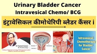 इंट्रावेसिकल कीमोथेरिपी ब्लैडर कैंसर Intravesical chemotherapy bladder cancer DrSantosh Kumar PGI [upl. by Eohce663]