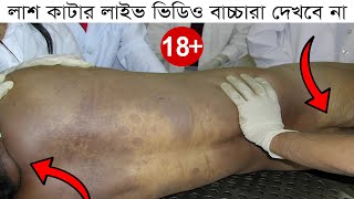 লাশ কাটা ঘরের লাইভ ভিডিও ইতিহাস ময়নাতদন্তMorgue Of Bangladesh Kolkata Medical College amp Hospital [upl. by Tallulah]