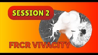 FRCR VIVACITY SESSION 2 [upl. by Sublett772]