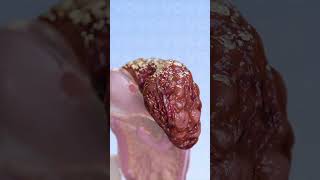 Cirrhosis of the liver  3D visualisation meded anatomy [upl. by Chandal377]