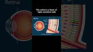 What to avoid if a person has a detached retina [upl. by Anerrol]