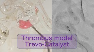 Stroke Thrombus Model Trevo StentRetriever amp Catalyst Aspiration Catheter [upl. by Child]