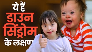 Down Syndrome Symptoms बच्चों में दिखने वाले ये लक्षण हो सकते हैं डाउन सिंड्रोम के [upl. by Ramraj]