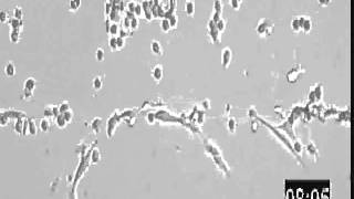 HT1080 migrating into matrigel [upl. by Dorthea]