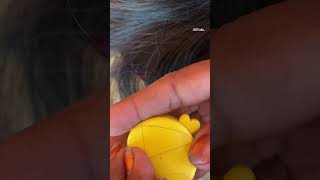 ASMR Lice and Nits Removal for Ultimate Scalp Check  Satisfying [upl. by Euhc]