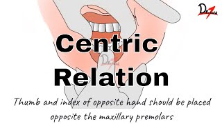 How to Determine Centric Relation PROSTHODONTICS [upl. by Auqkinahs427]