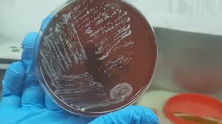 Uncovering The Fascinating Colony Morphology Of Nocardia [upl. by Durrace]