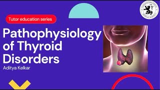 Pathophysiology of Thyroid Disorders [upl. by Helena]