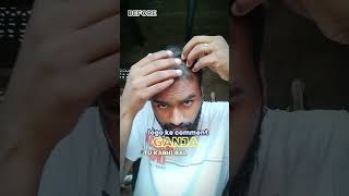 Day 46  100 hair regrowth challenge ytshortsvideo hairfall [upl. by Kirred964]