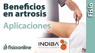 Beneficios y aplicaciones de INDIBA ACTIV para la artrosis [upl. by Nywles742]