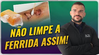 POSSO LIMPAR FERIDA COM ÁGUA E SABÃO [upl. by Nolram]