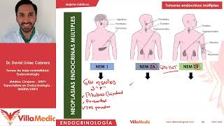 Tumores endocrinos múltiples  Endocrinologia [upl. by Aned803]