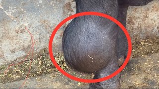 Hygroma of knee l Dr Umar Khan [upl. by Nirik277]