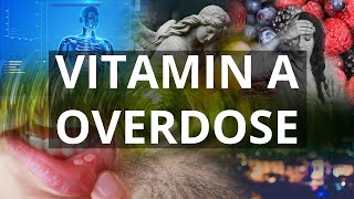 Vitamin A Overdose Symptoms Hypervitaminosis A Drowsiness Irritability Abdominal Pain Nausea [upl. by Eitsym748]