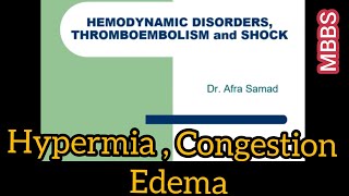 HEMODYNAMIC DISORDERS THROMBOEMBOLISM and SHOCK  G pathology  Hypermia Congestion amp Edema [upl. by Emogene]