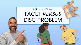 What are the Differences Between a Disc Problem and a Facet Problem  Expert Physio Review [upl. by Ruhl711]