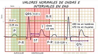 ELECTROCARDIOGRAMA NORMAL GUÍA DEFINITIVA [upl. by Eirelam569]