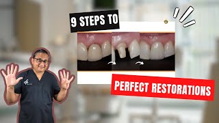 Indirect Restorations 9 steps to Success [upl. by Ydniw]