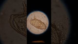 Schistosoma mansoni from my lab بويضة بلهارسيا [upl. by Aicemat]