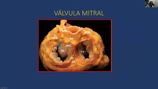 Primer curso virtual de Cardiología  Válvula Mitral [upl. by Cirtap324]