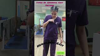 Abnormal Gait Pattern hemiplegia medical doctor physio viralvideo [upl. by Topliffe]