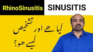 What Is RhinoSinusitis amp Sinusitis [upl. by Hak]