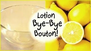 DIY Acné • Lotion Bye Bye Bouton [upl. by Eelytsirk]