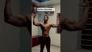 Before and after steroids 💉 steroid gym bodybuilding bodybuilder trending shorts fitness [upl. by Adnama]