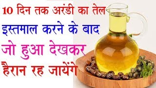 Benefits of Castor Oil अरंडी के तेल के ये चमत्कारी लाभ Health Benefits of Castor Oil [upl. by Rita176]