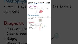 ORAL LICHEN PLANUS EXPLAINED [upl. by Domash69]