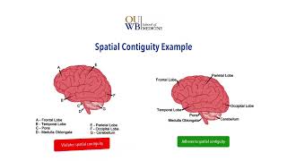 CL6 The Contiguity Principle [upl. by Mace]