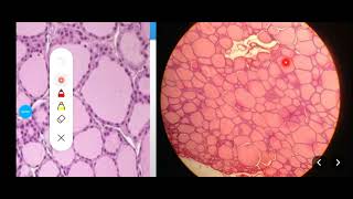 Histology Slides Series Episode 16  Histology of Endocrine Organs [upl. by Ihtak493]