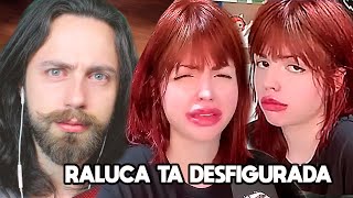 raluca aparece DESFIGURADA e pedindo desculpas [upl. by Suedaht]