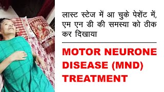 Motor Neuron Disease MND Treatment  Treatment given by Dr Ashish Gilhotra [upl. by Pulchi]