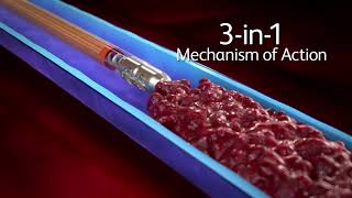 Aspirex™ Thrombectomy System 3in1 Mechanism of Action [upl. by Edholm]